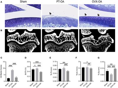 Distinct pathological changes of osteochondral units in early OVX-OA involving TGF-β signaling